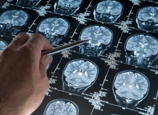 Chiny zezwoliły na użycie pierwszego na świecie komercyjnego systemu neurokomputerowego